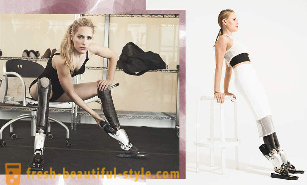 Bellezza infinita: 6 modelli femminili con protesi