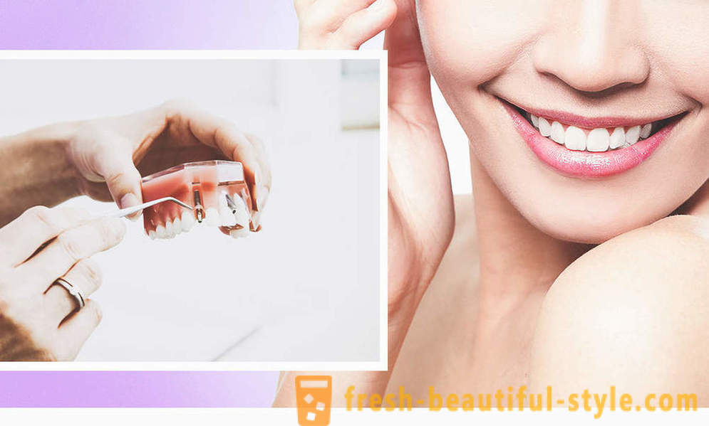 4, il modo ideale per rendere i denti