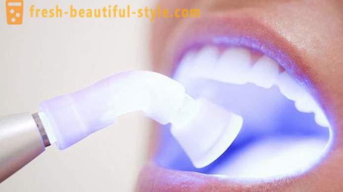 7 di sostanze nocive per i denti, che non si sapeva mai esistito