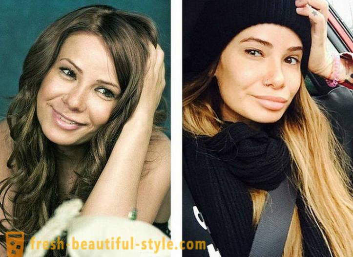 10 bellezze russe, prima e dopo di plastica