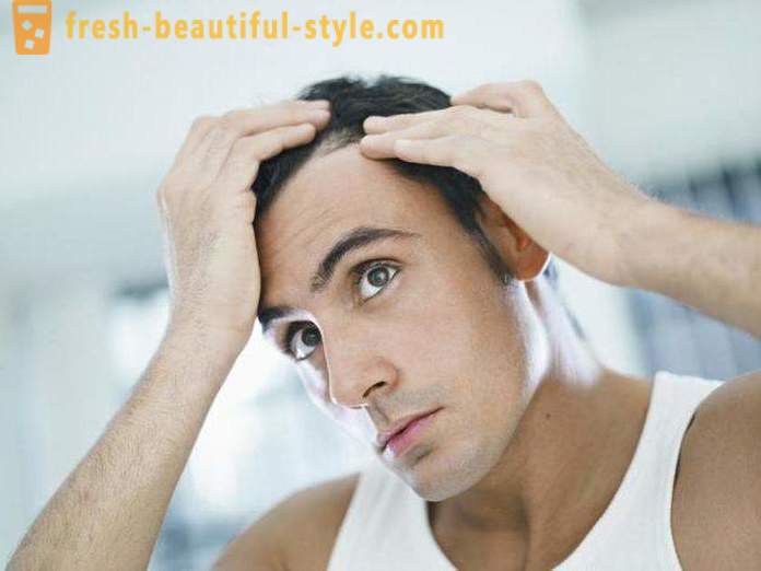 Farmaci con minoxidil per capelli: recensioni, caratteristiche e descrizione dell'applicazione delle migliori