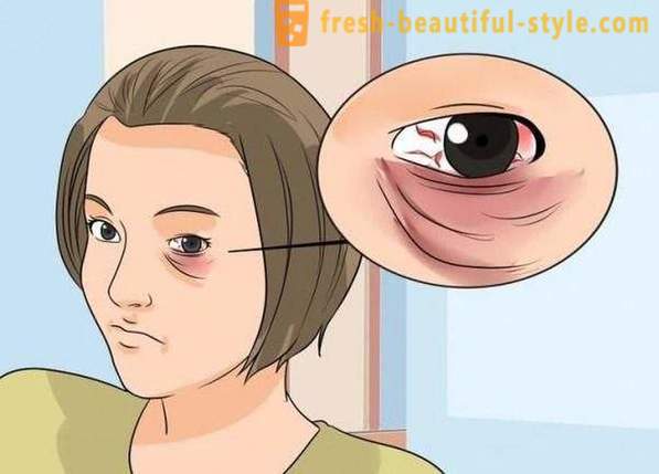 Come mascherare un occhio nero da un colpo: cosmetici, in particolare raccomandazioni e