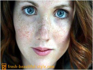 Prendersi cura della loro bellezza e giovinezza: provoca la pigmentazione sul viso